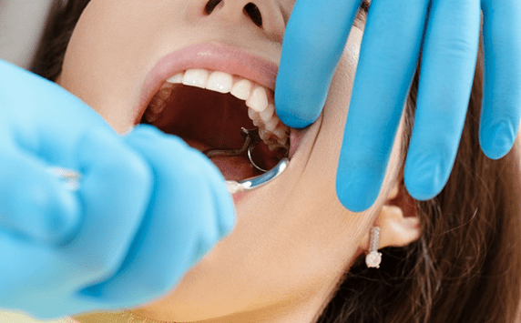 Удаление зубов любой сложности